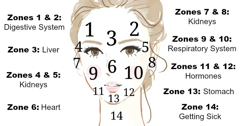 Acne Zone Chart